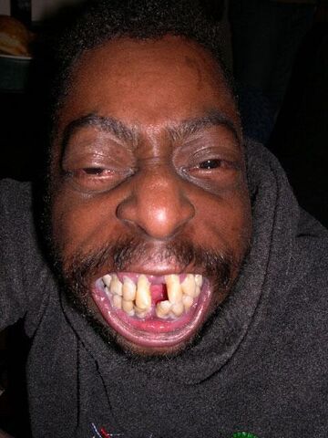File:Crackhead 5.jpg