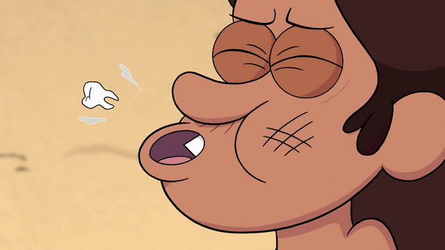 File:S1e15 spitting a tooth.png