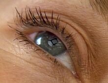 Eye