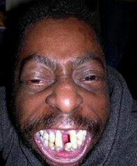 Ugly-and-Weird-People-Ugly-Teeth-02