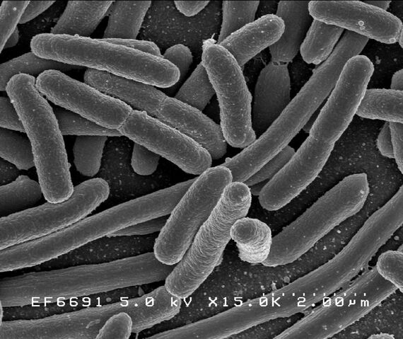 File:EscherichiaColi NIAID.jpg