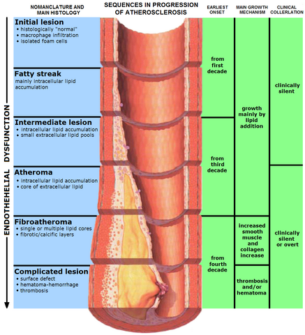 File:Endo dysfunction Athero.png