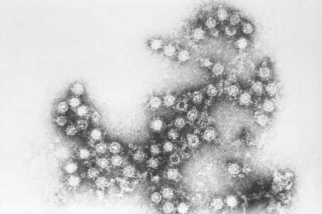 File:Coxsackie B4 virus.jpg