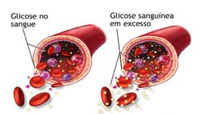 Diabetes2-figura1