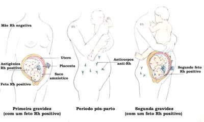 Arquivo:Figura2 DHP.jpg
