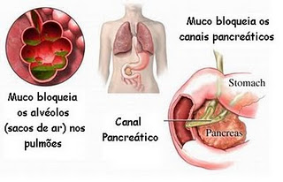 Arquivo:Fig.fibrosecistica2.jpg.jpg