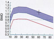 Osteoporose4.jpg