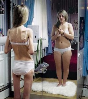 Arquivo:Anorexia-y-bulimia1.jpg
