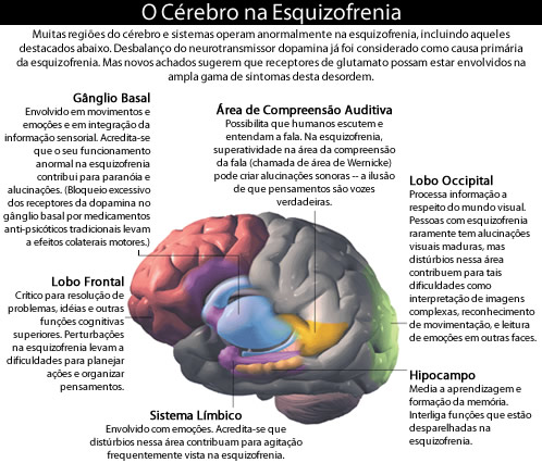 Esquizofrenia figura2