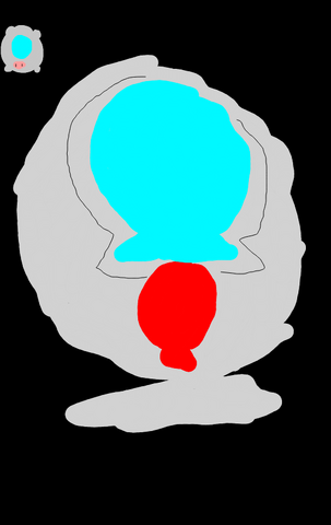 File:AbsolutelySafeBloonCapsule.png
