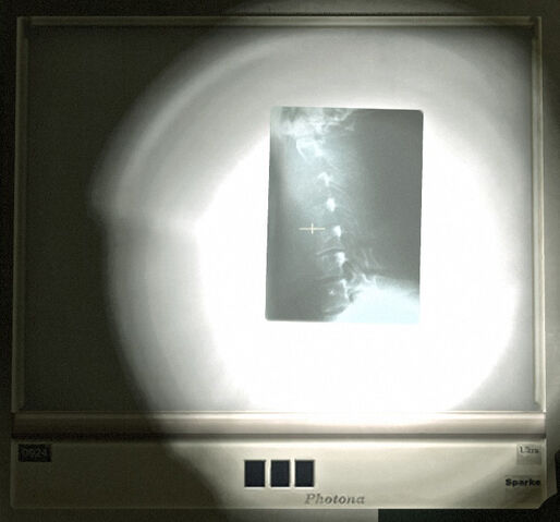 File:Left-4-Dead-1-Spitter-Teaser.jpg