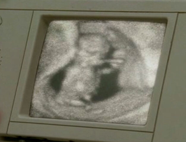 Файл:Ultrasound.jpg