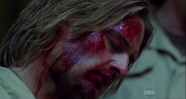 File:5x15 Bloody sawyer.png