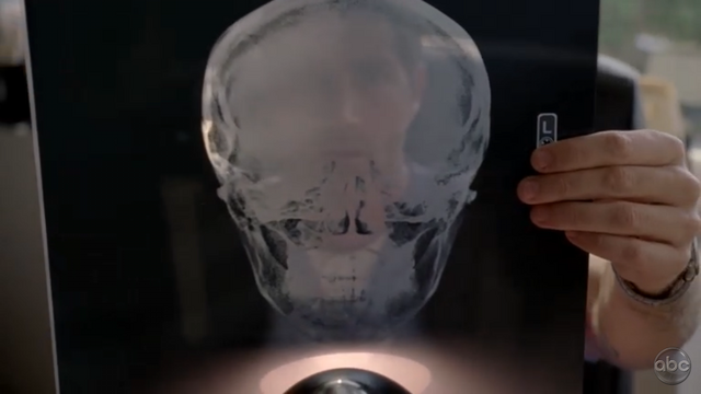 File:6x17 MindXray.png