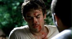 1x08Boone.jpg