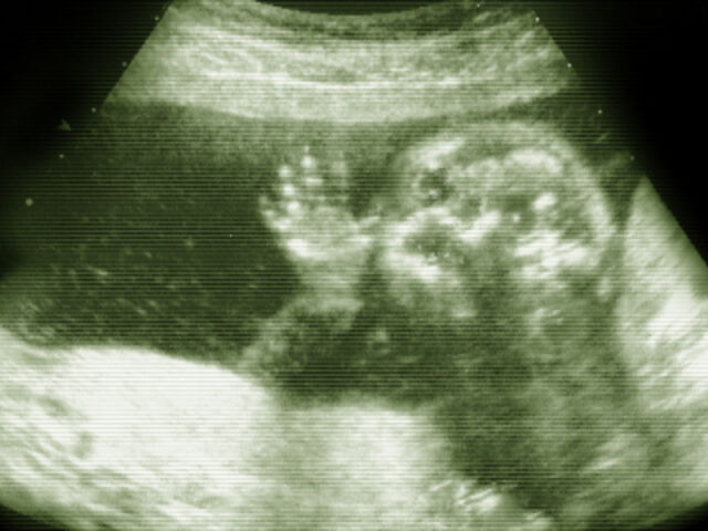File:Baby.jpg