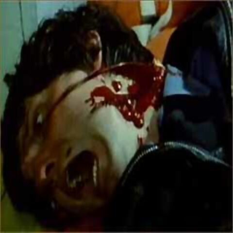 File:Zombie neckshot.jpg