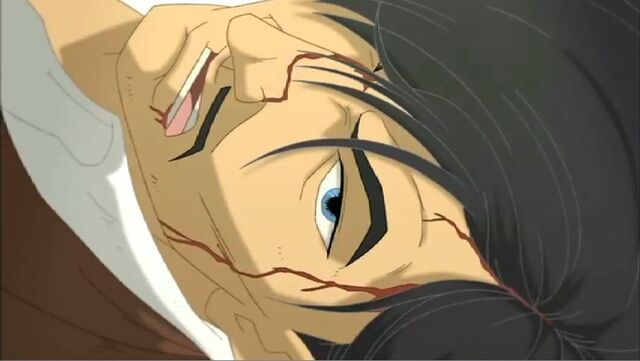 File:Tony Injured IIM.jpg