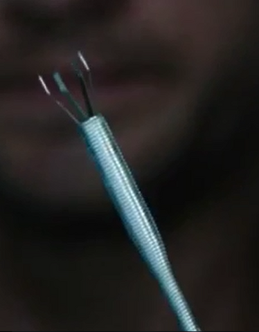 File:Paranasal.png