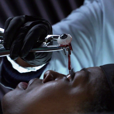 File:BackscatterXrayEyeImplant-AoSES.png