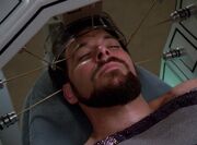Riker Stimulation der Nerven.jpg