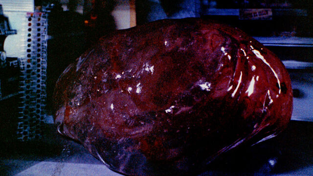 Plik:Blob.jpg