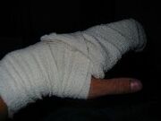 Bandaged hand