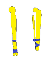 Vorian bones