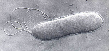 Prokaryote