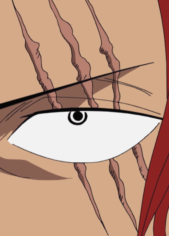 File:Shanks' Scars.png