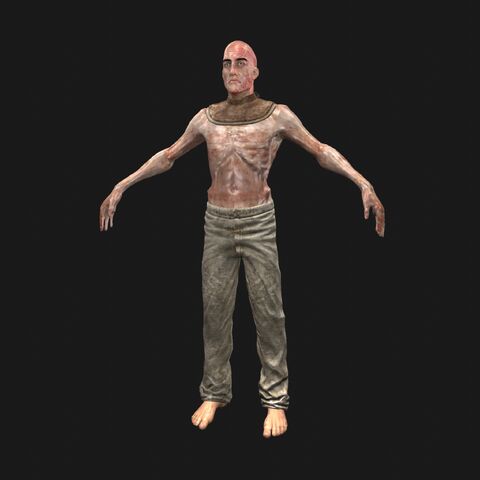 File:Patient6 perspFront.jpeg