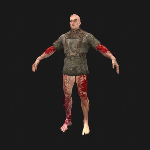 File:Patient10 perspFront.jpeg
