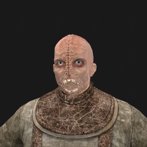 File:Patient13 face.jpeg