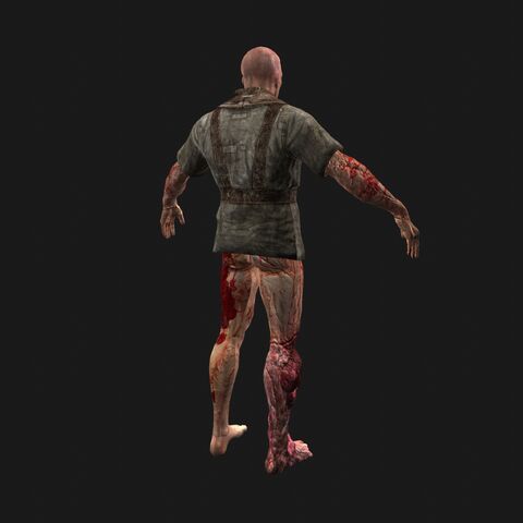 File:Patient10 perspBack.jpeg