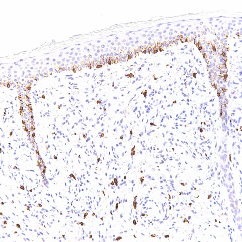 File:CD117.melanocytes.normal..jpg