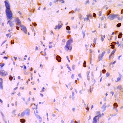 File:Myogenin.mast cells.400x.1.jpg
