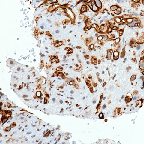 File:CD34.EHE.1.jpg