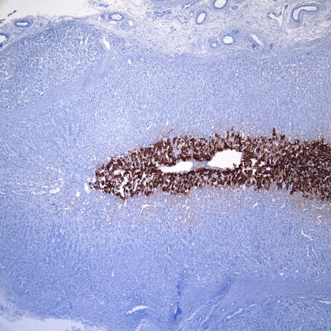 File:Chromogranin.adrenal medulla.2..jpg