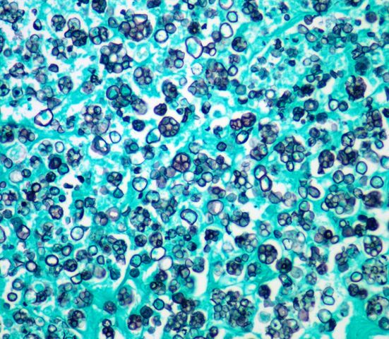 File:Prototheca.GMS Stain.2.jpg