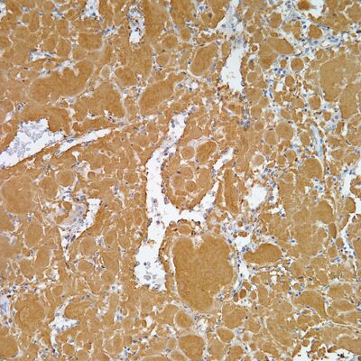 Amyloid A