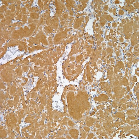 File:Amyloid A.jpg