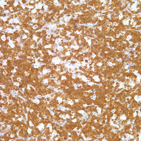 File:ALK-1.ALCL.jpg