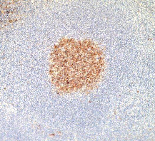 File:CD10.germinal center.jpg