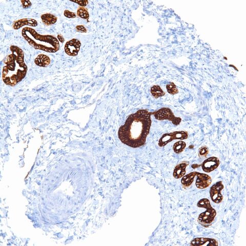 File:CK7.proliferating bile ductules.jpg
