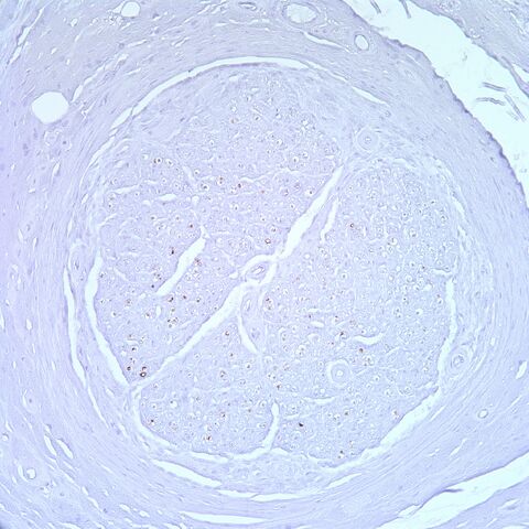 File:Neurofilament.nerve.jpg