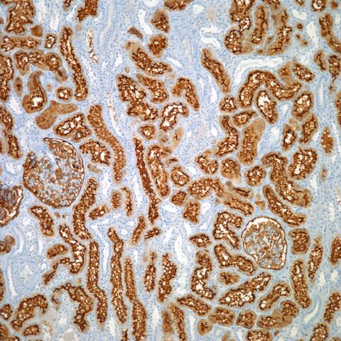File:CD10.kidney.jpg