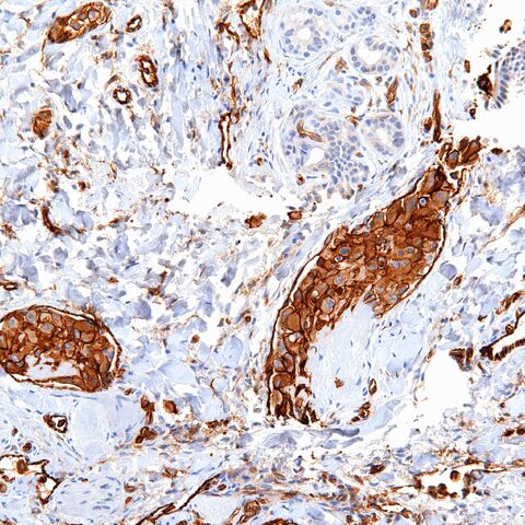 File:CD31.EHE.1.jpg