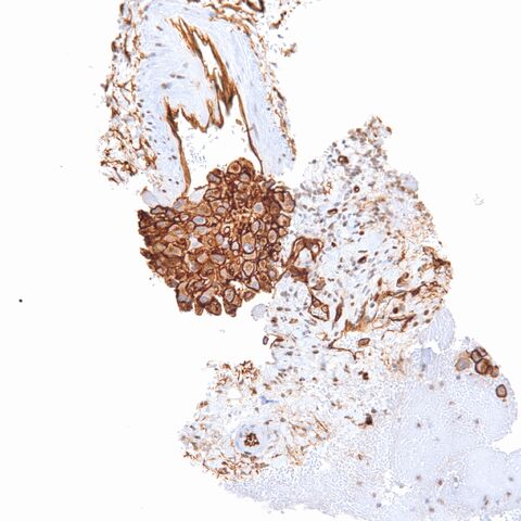 File:CD34.EHE.2.jpg