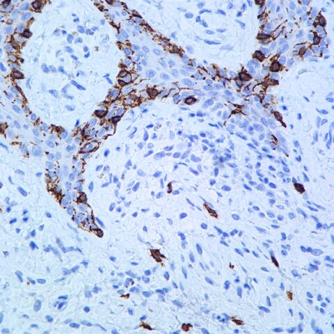 File:CD117.melanocytes.400x.basic.jpg
