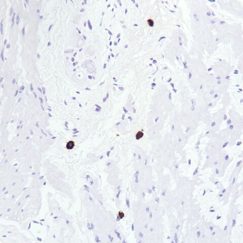 File:Tryptase.mast cell.2.jpg